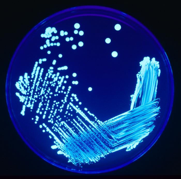 Aïllament per sembra escocesa de Legionella sp. sota il·luminació ultraviolada. Font Viquipèdia